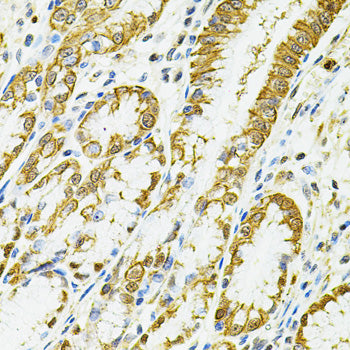 HLA-DQA1 Rabbit pAb