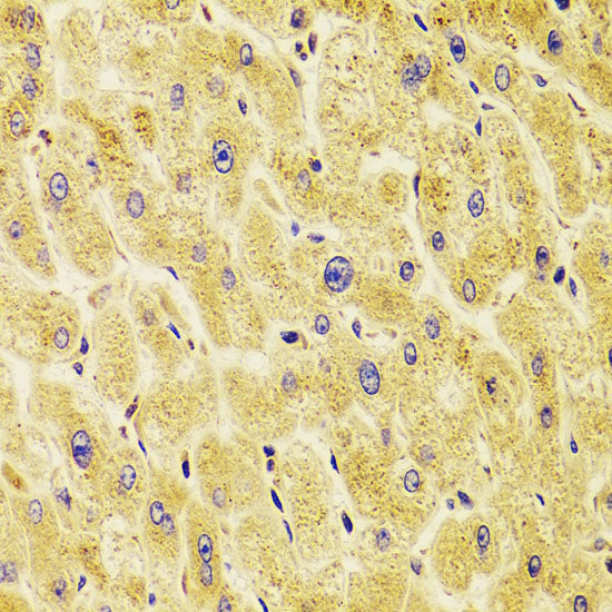 TXNL1 Rabbit pAb
