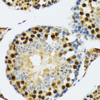 TXNL1 Rabbit pAb