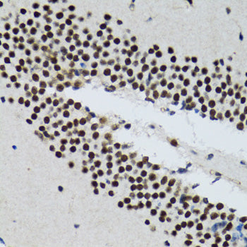 TXNL1 Rabbit pAb