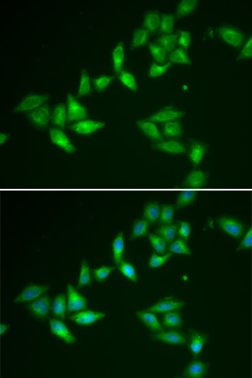 TXNL1 Rabbit pAb