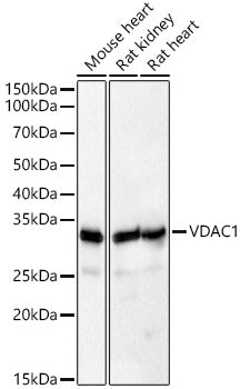 [KD Validated] VDAC1 Rabbit pAb