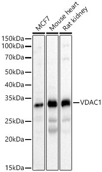 [KD Validated] VDAC1 Rabbit pAb