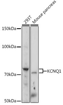 KCNQ1 Rabbit pAb