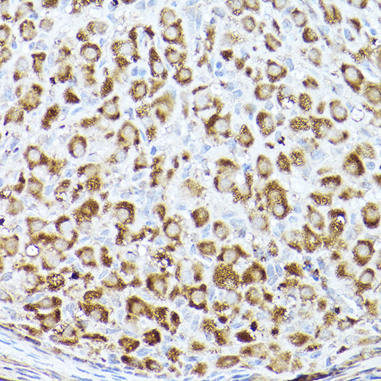 ACC1 Rabbit pAb