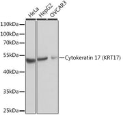 Cytokeratin 17 (KRT17) Rabbit pAb