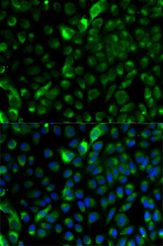 Cytokeratin 17 (KRT17) Rabbit pAb