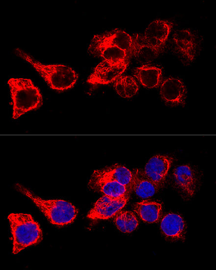 Cytokeratin 17 (KRT17) Rabbit pAb