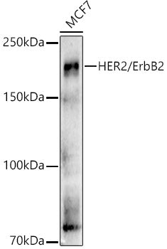 [KO Validated] HER2/ErbB2 Rabbit pAb