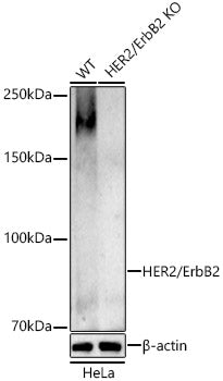 [KO Validated] HER2/ErbB2 Rabbit pAb