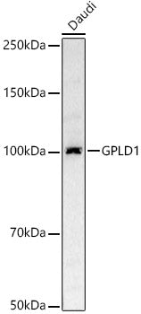 [KD Validated] GPLD1 Rabbit pAb