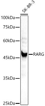 [KD Validated] RARG Rabbit pAb