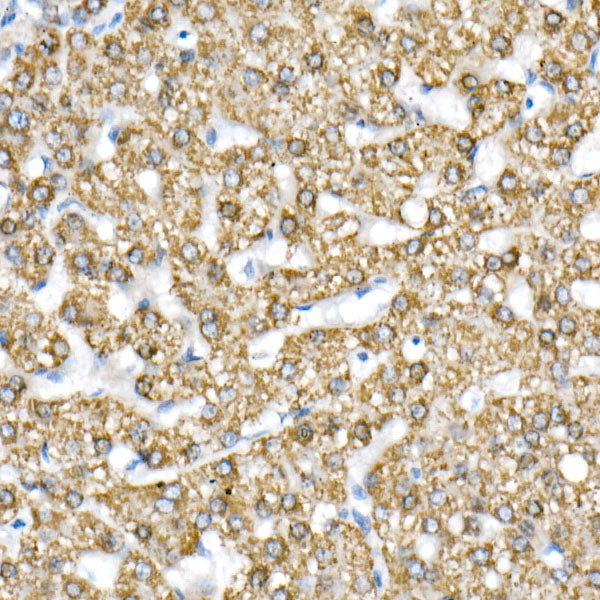 GLUD1/2 Rabbit mAb