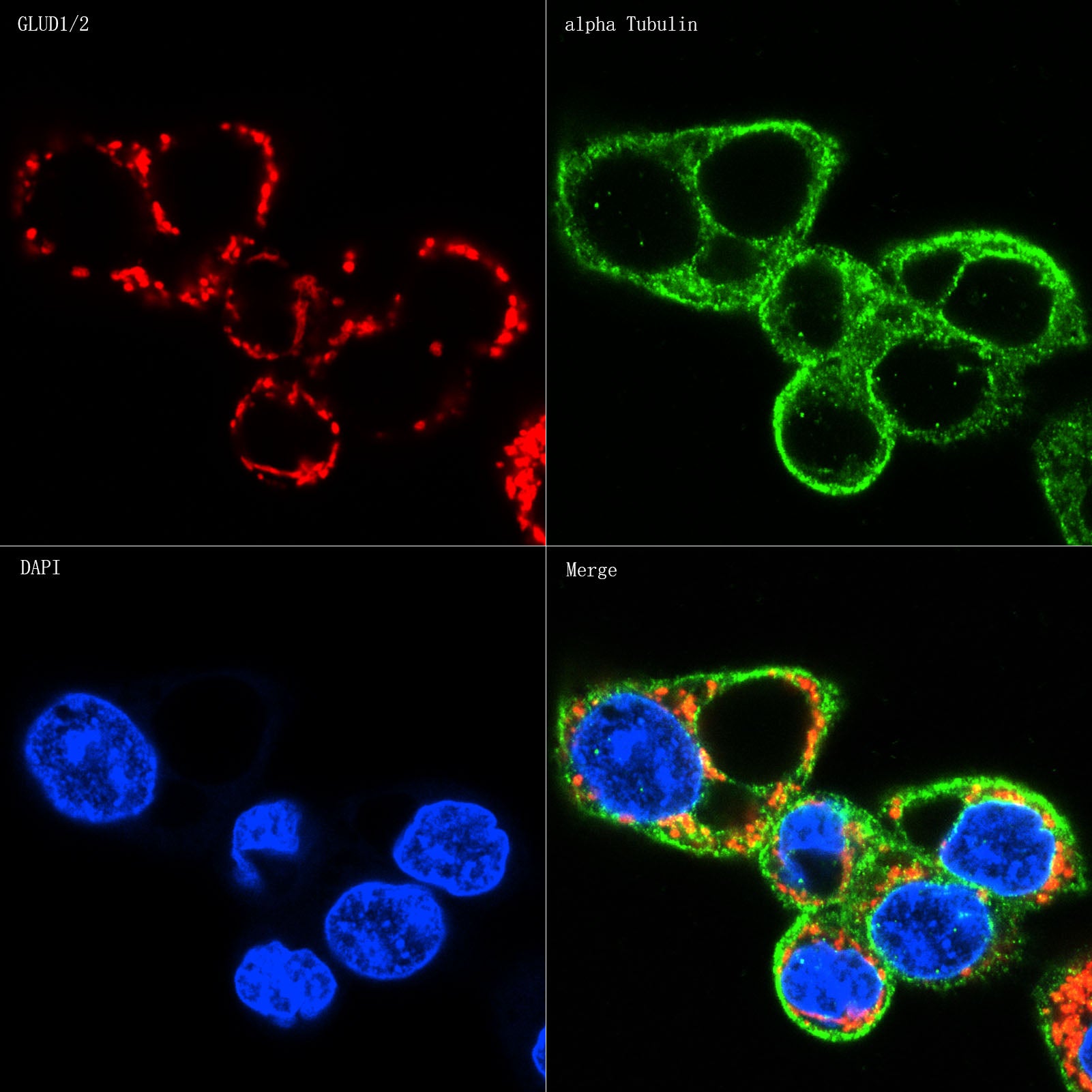 GLUD1/2 Rabbit mAb