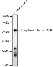 Complement factor B (CFB) Rabbit mAb
