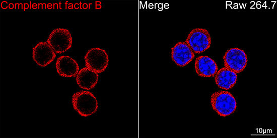 Complement factor B (CFB) Rabbit mAb