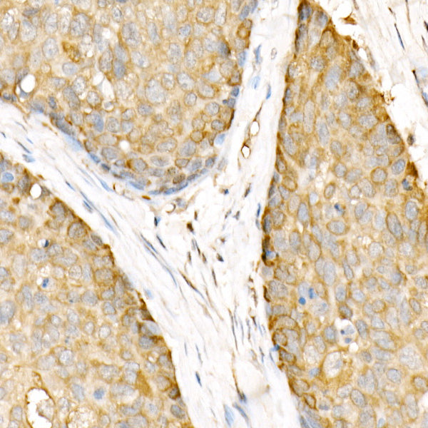 Hsp90β Rabbit pAb
