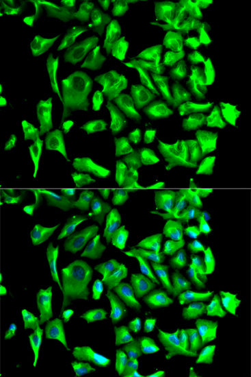 Hsp90β Rabbit pAb