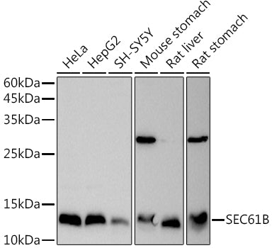 SEC61B Rabbit pAb