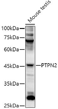 PTPN2 Rabbit pAb