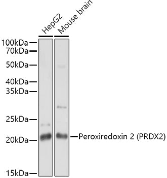 Peroxiredoxin 2 (PRDX2) Rabbit pAb