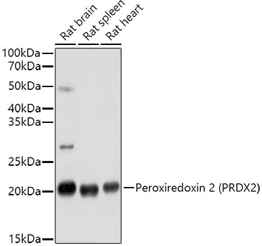 Peroxiredoxin 2 (PRDX2) Rabbit pAb