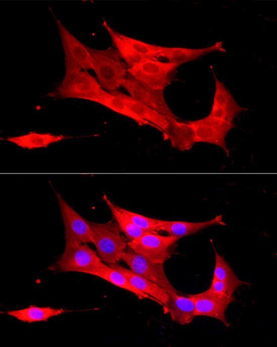 Peroxiredoxin 2 (PRDX2) Rabbit pAb