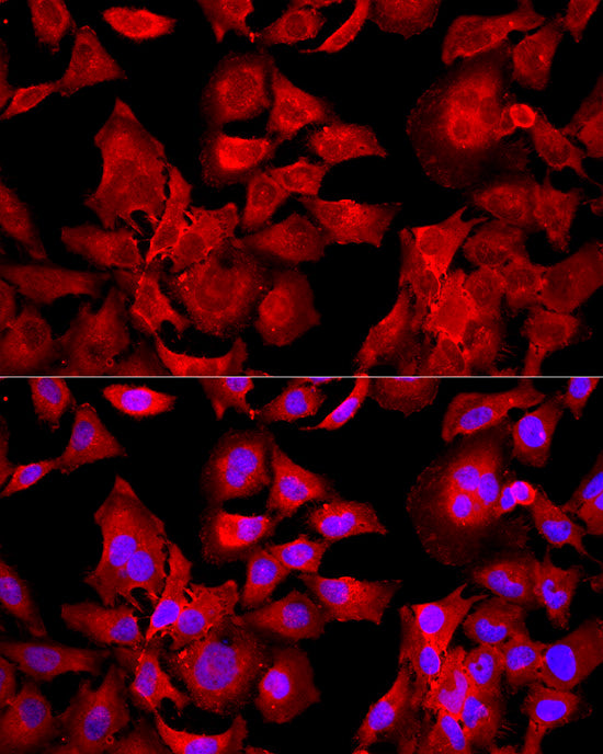 Peroxiredoxin 2 (PRDX2) Rabbit pAb