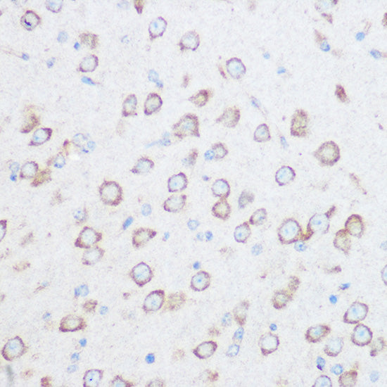 NG2/CSPG4 Rabbit pAb
