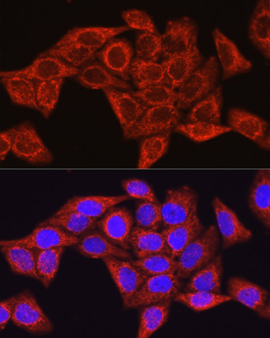 Glutamine Synthetase (GLUL) Rabbit pAb