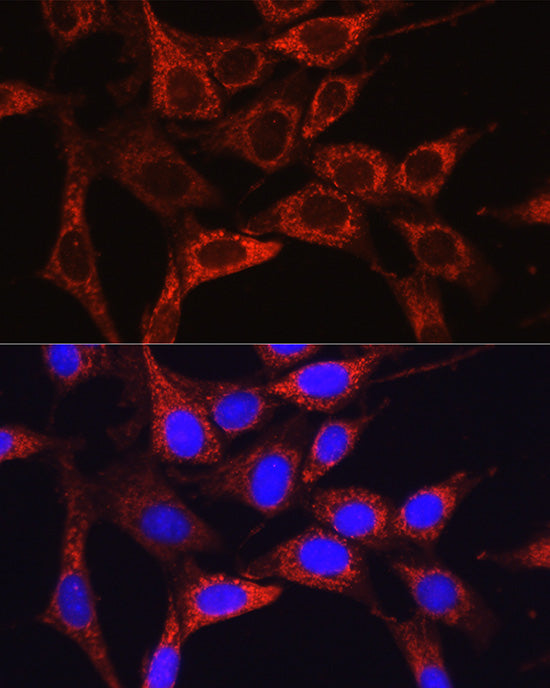 Glutamine Synthetase (GLUL) Rabbit pAb