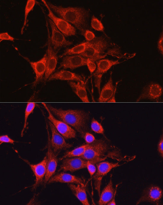 Glutamine Synthetase (GLUL) Rabbit pAb