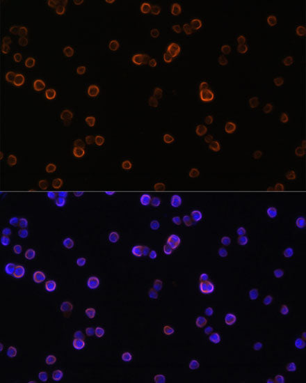 PLC gamma 2 (PLCG2) Rabbit pAb