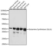 Glutamine Synthetase (GLUL) Rabbit mAb
