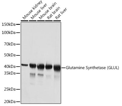 Glutamine Synthetase (GLUL) Rabbit mAb