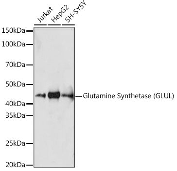 Glutamine Synthetase (GLUL) Rabbit mAb