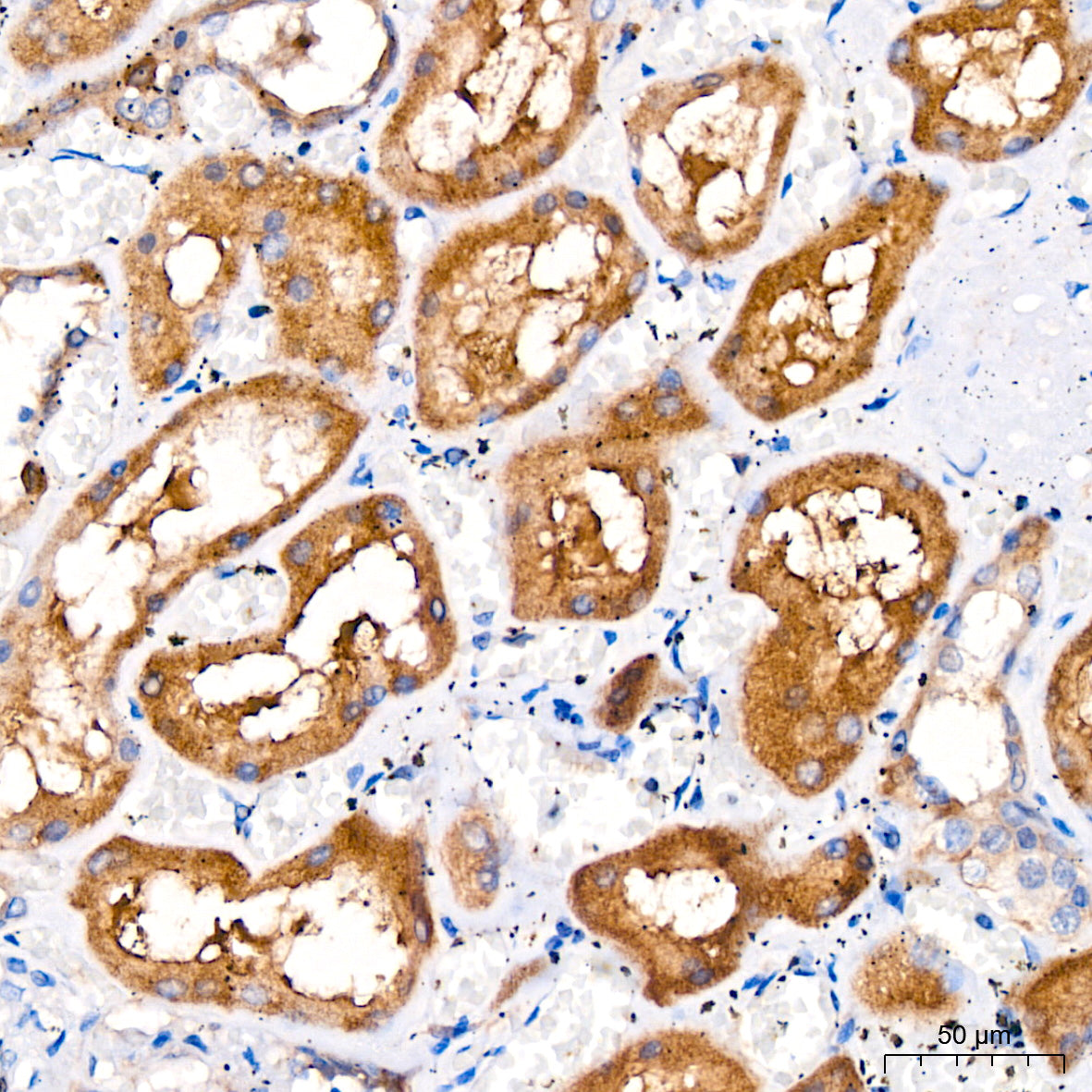 Glutamine Synthetase (GLUL) Rabbit mAb