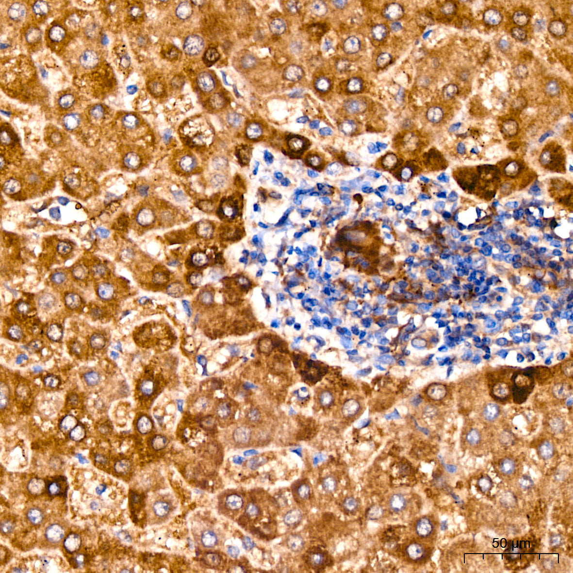 Glutamine Synthetase (GLUL) Rabbit mAb