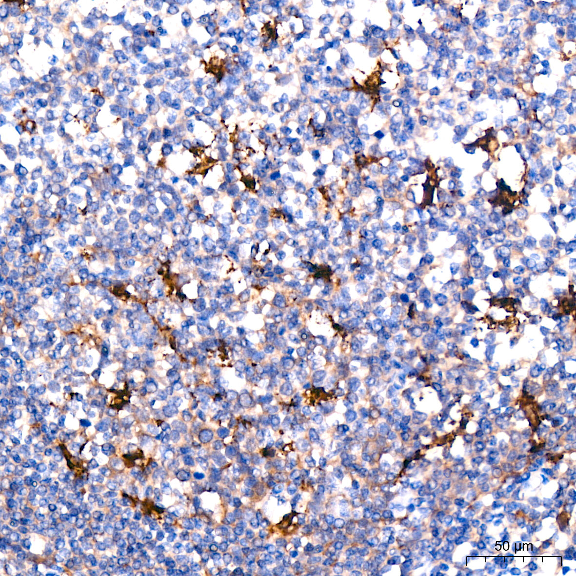 Glutamine Synthetase (GLUL) Rabbit mAb