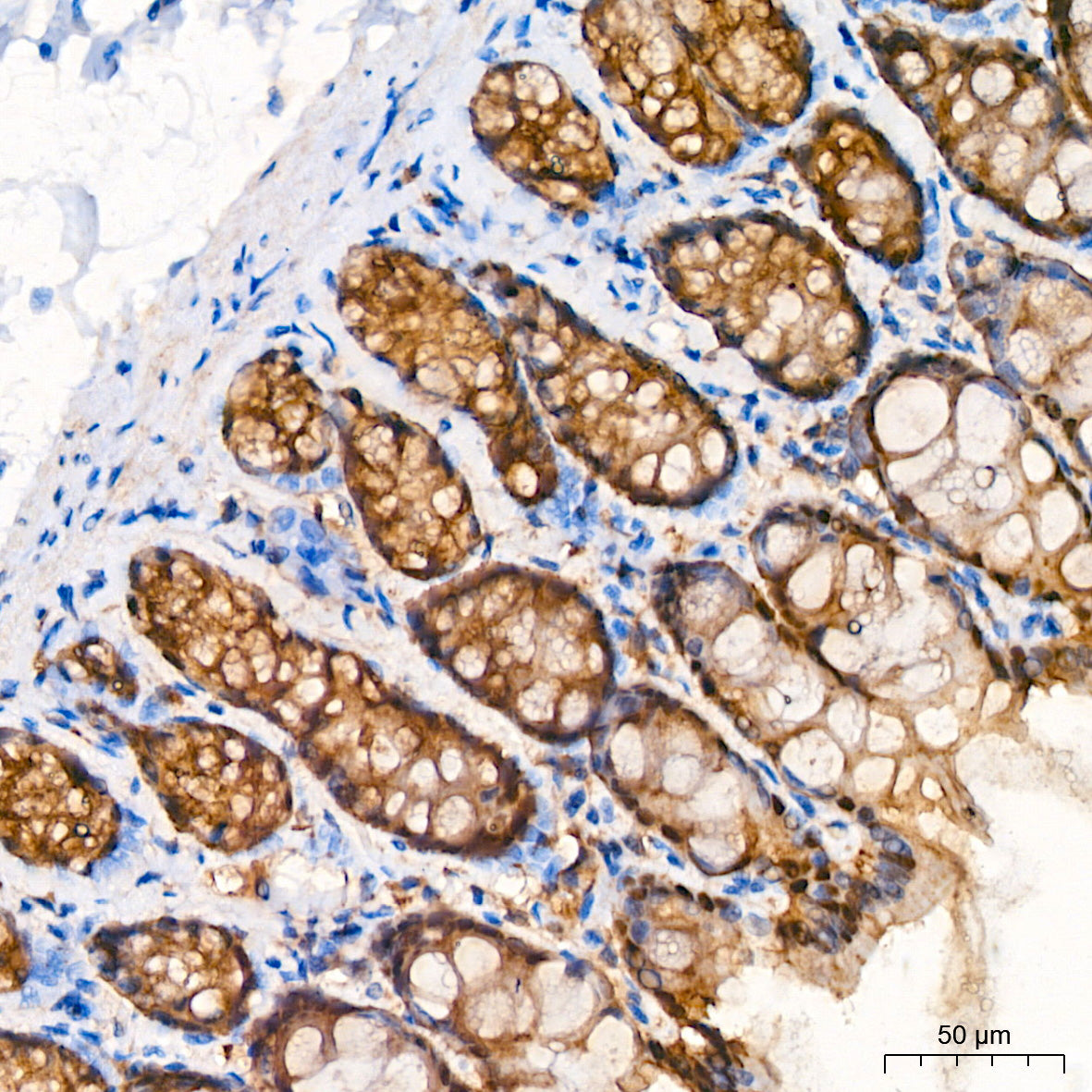 Glutamine Synthetase (GLUL) Rabbit mAb