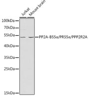PP2A-B55α/PR55α/PPP2R2A Rabbit pAb