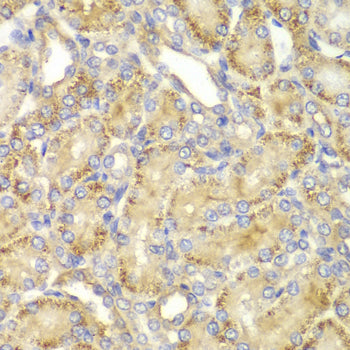PP2A-B55α/PR55α/PPP2R2A Rabbit pAb