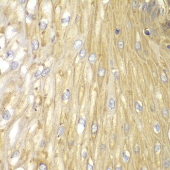 PP2A-B55α/PR55α/PPP2R2A Rabbit pAb