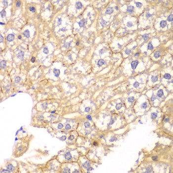 PP2A-B55α/PR55α/PPP2R2A Rabbit pAb