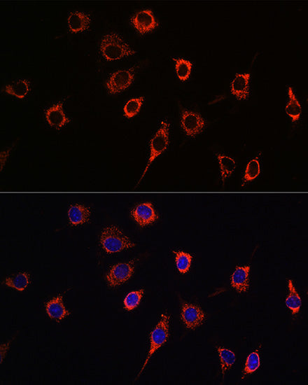 Presenilin 1 Rabbit pAb