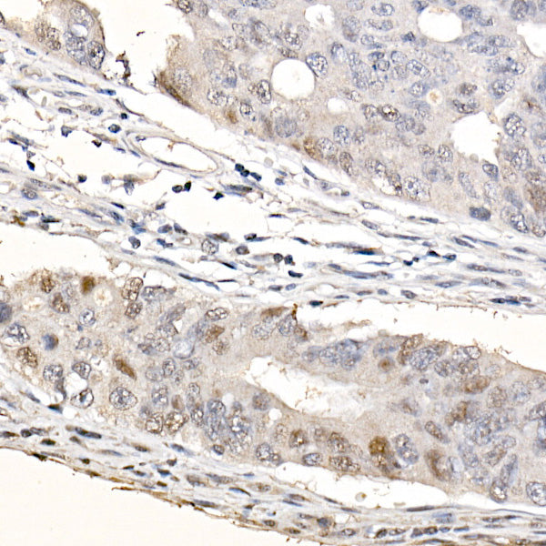 CDKN1A/p21CIP1 Rabbit mAb