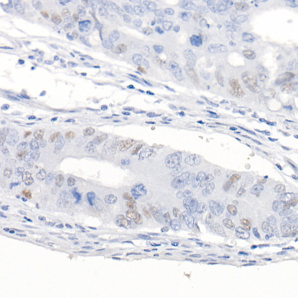 CDKN1A/p21CIP1 Rabbit mAb