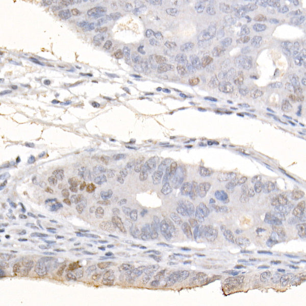 CDKN1A/p21CIP1 Rabbit mAb