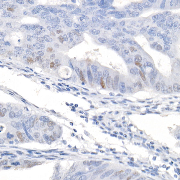 CDKN1A/p21CIP1 Rabbit mAb