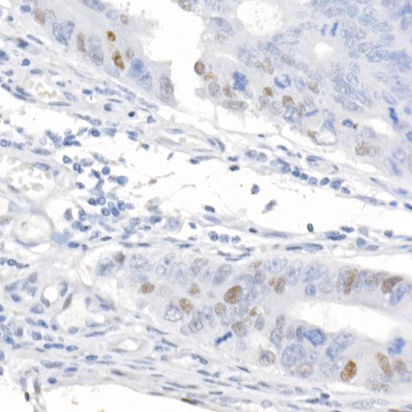 CDKN1A/p21CIP1 Rabbit mAb